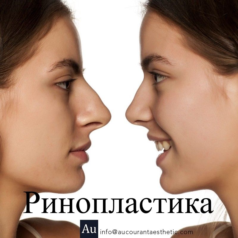 Пластическая хирургия